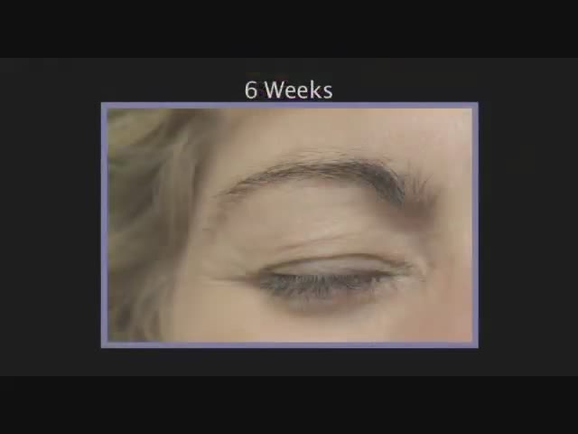 RapidLash Before and After Testimonials - image 1 from the video