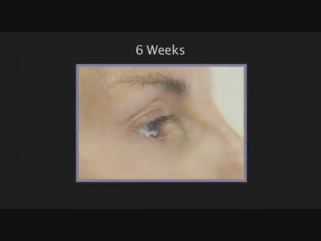 RapidLash Before and After Testimonials - image 2 from the video