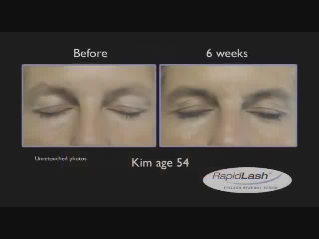 RapidLash Before and After Testimonials - image 4 from the video