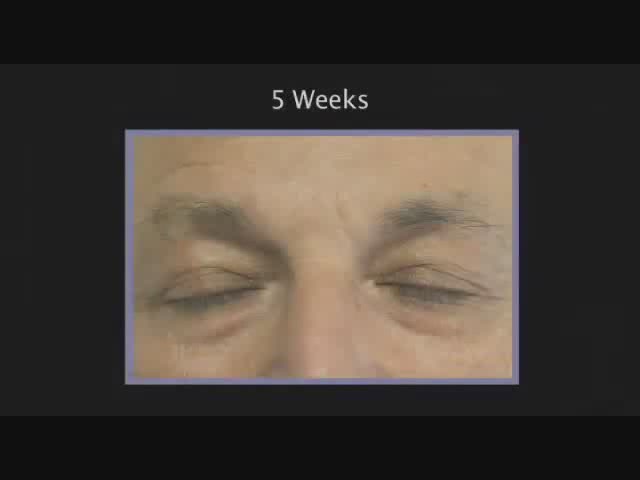 RapidLash Before and After Testimonials - image 5 from the video