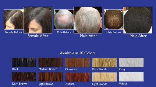 Infinity Hair Fibers: Hair Loss Concealing Fibers for Men & Women - image 9 from the video
