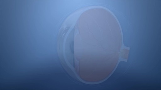 AIR OPTIX AQUA Multifocal contact lenses product | VisionDirect.com - image 2 from the video